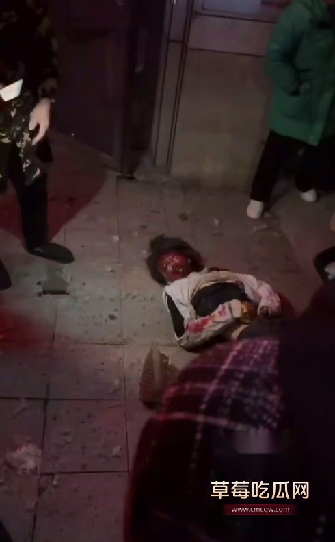 重庆炸井盖重伤2.jpg 重庆炸井盖重伤2.jpg