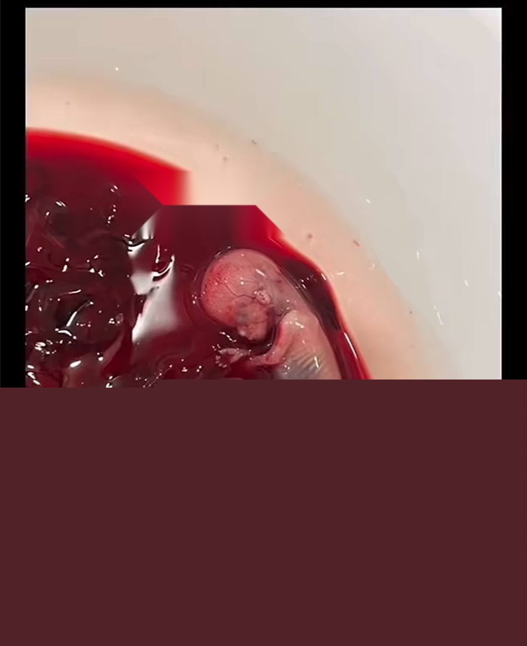 姚红超 董山山26.jpg 姚红超 董山山26.jpg