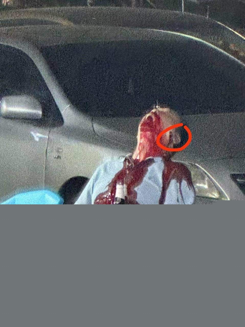 武汉烧烤摊枪击案 10