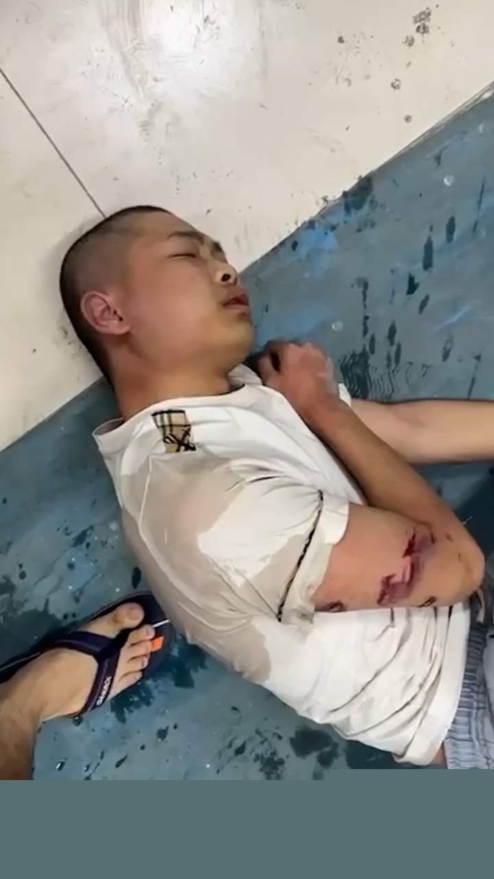 缅北猪仔被打 3 缅北猪仔被打 3