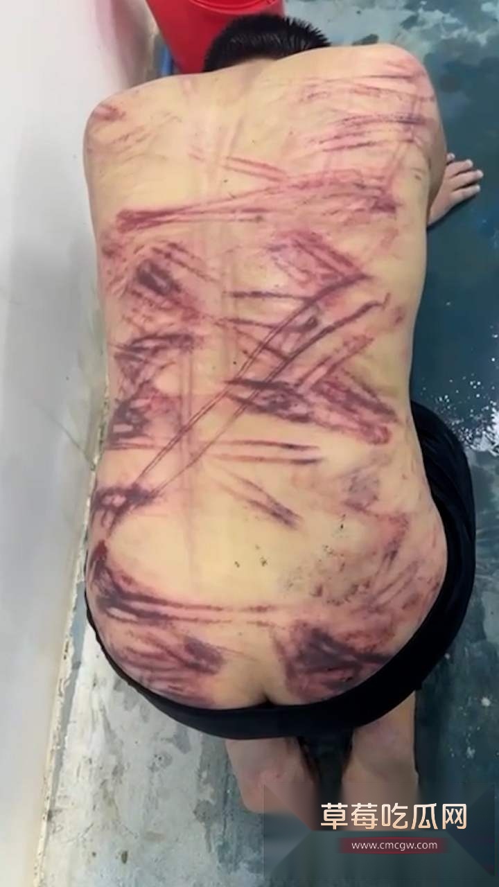 缅北猪仔被打 5 缅北猪仔被打 5