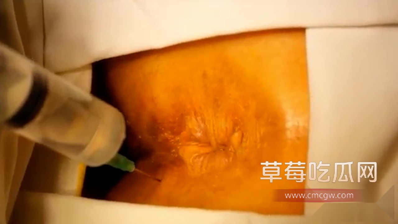 走后门把屁眼玩坏 4