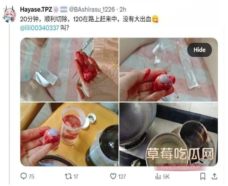 推特伪娘用刀片把蛋蛋给割下来 5