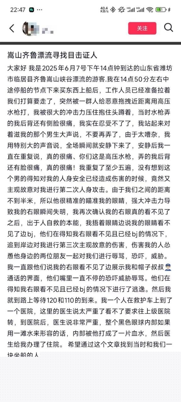 高压水枪射伤眼睛。1