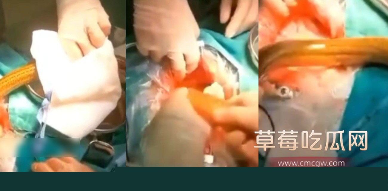 灌肠.jpg 灌肠.jpg