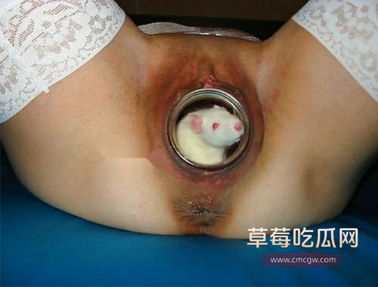 异物入体1.jpg 异物入体1.jpg