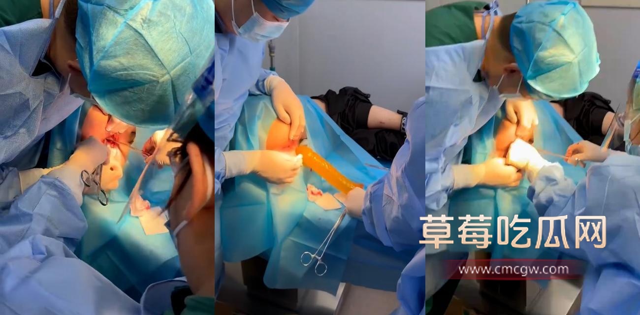 手术从肛门取出超大号自慰棒.jpg 手术从肛门取出超大号自慰棒.jpg