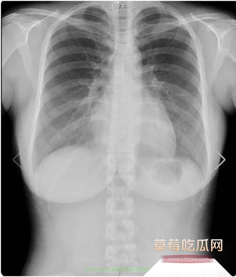 photo220250917184148