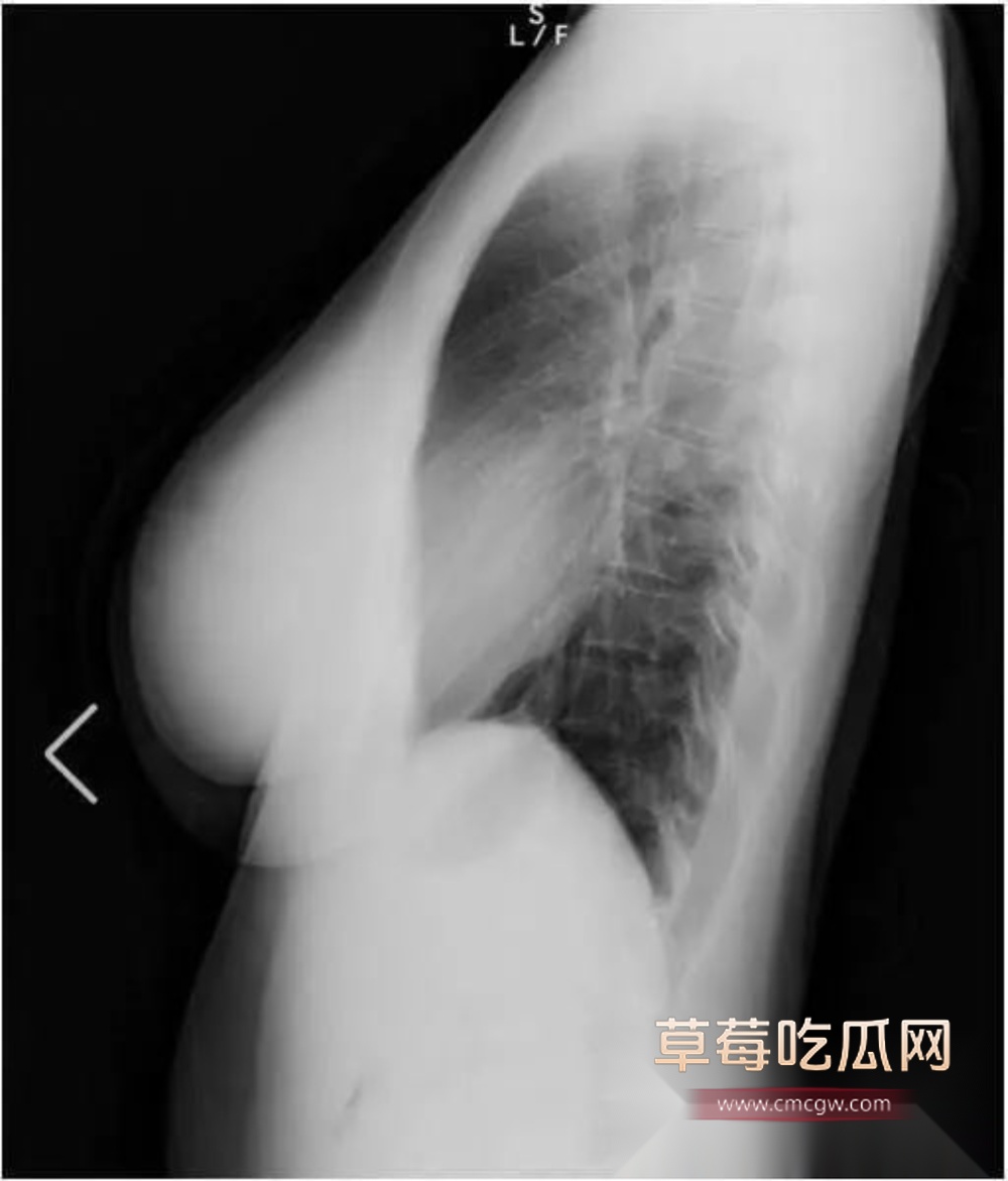 photo320250917184148