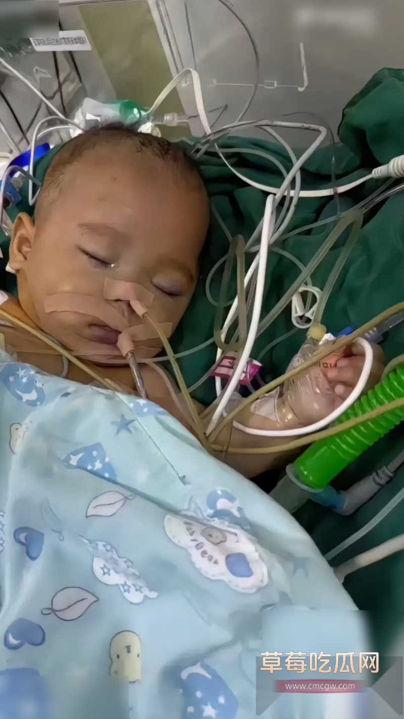 浙江宁波5月龄早产女婴 8