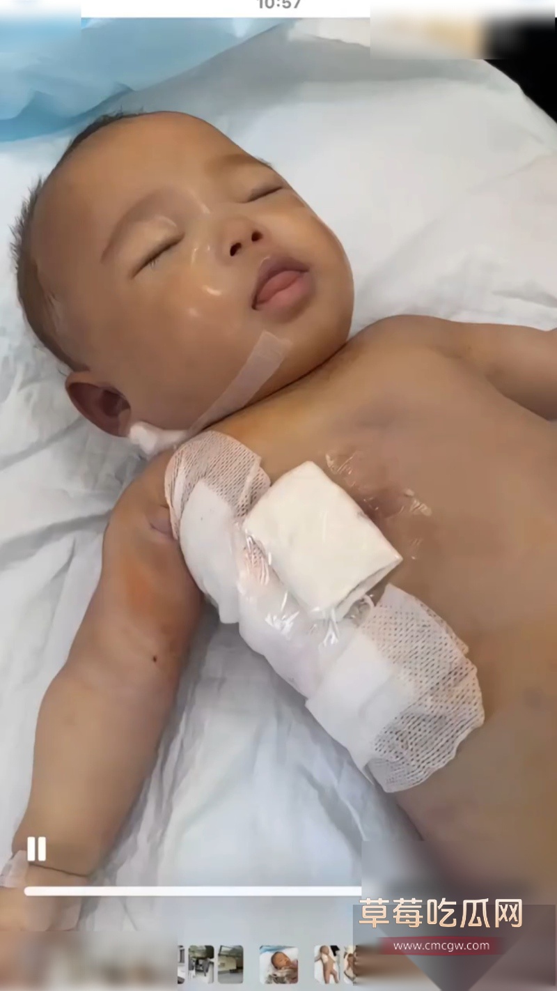 浙江宁波5月龄早产女婴 9