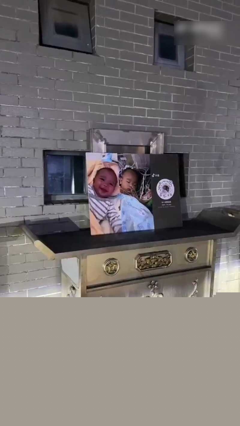 浙江宁波5月龄早产女婴 12