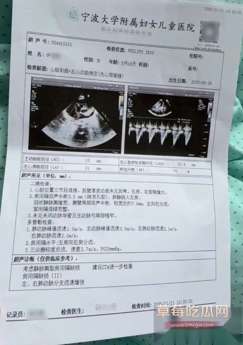 浙江宁波5月龄早产女婴 15