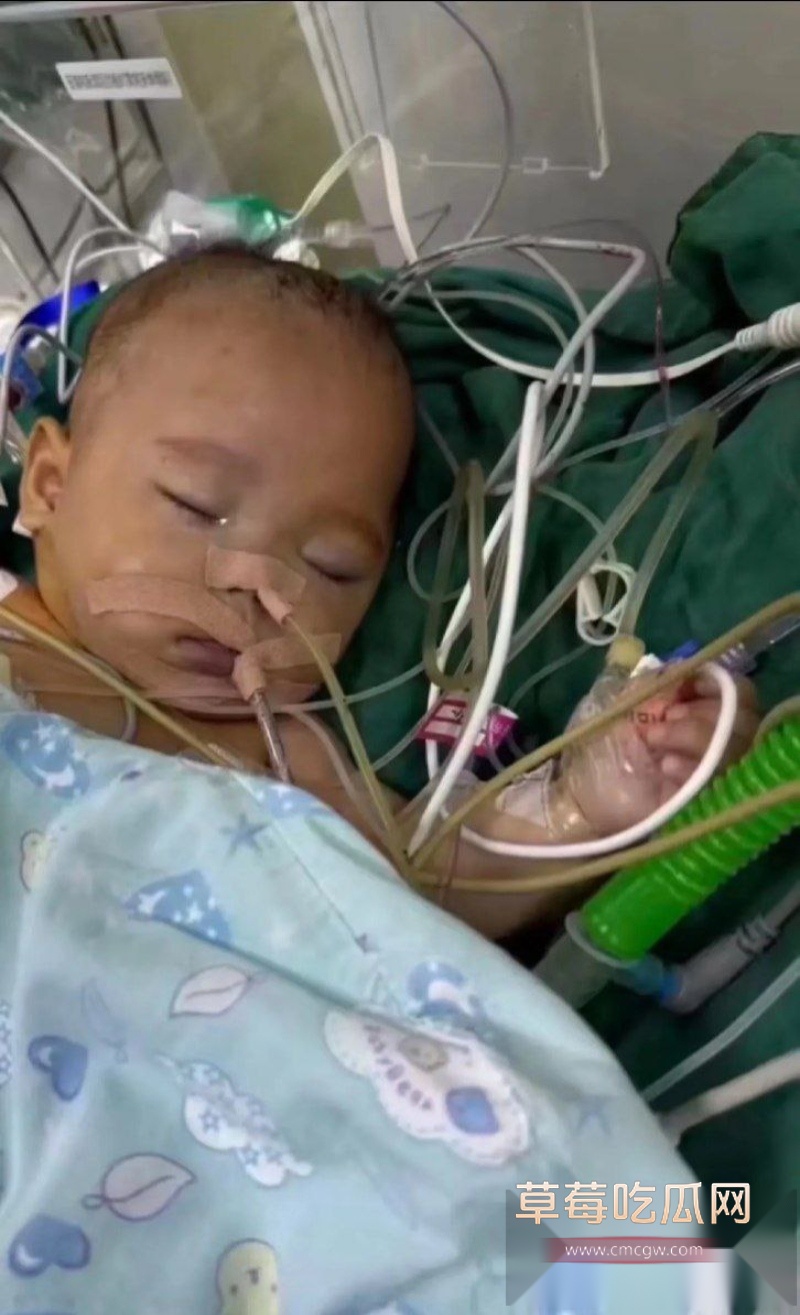 浙江宁波5月龄早产女婴 16