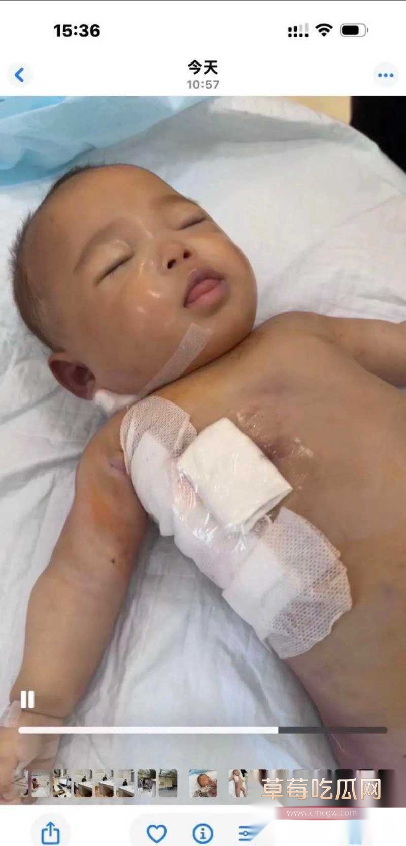 浙江宁波5月龄早产女婴 17