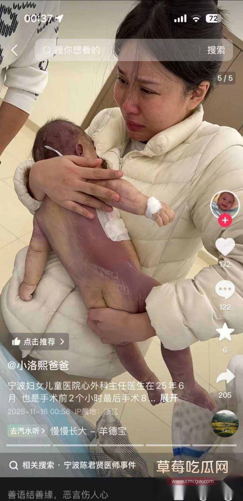 浙江宁波5月龄早产女婴 18