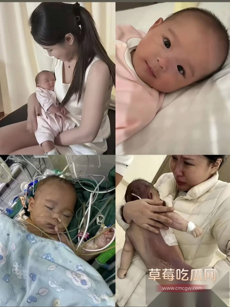 浙江宁波5月龄早产女婴 20