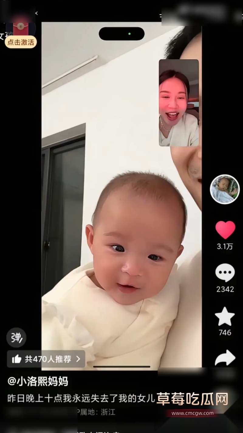 浙江宁波5月龄早产女婴 7