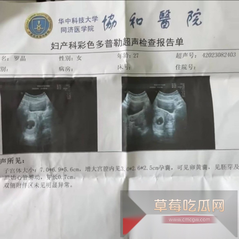 抖音写亡妻回忆录的男博主 给自己制造日落 翻车 粉丝翻出其因车祸去世的美女老婆在微博曾曝出丈夫多次出轨约炮视频记录！ 20