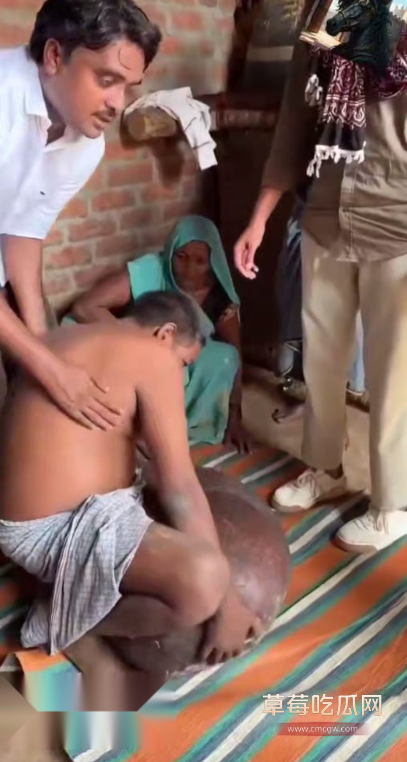 外国男子遭丝虫病入侵下体2 外国男子遭丝虫病入侵下体2