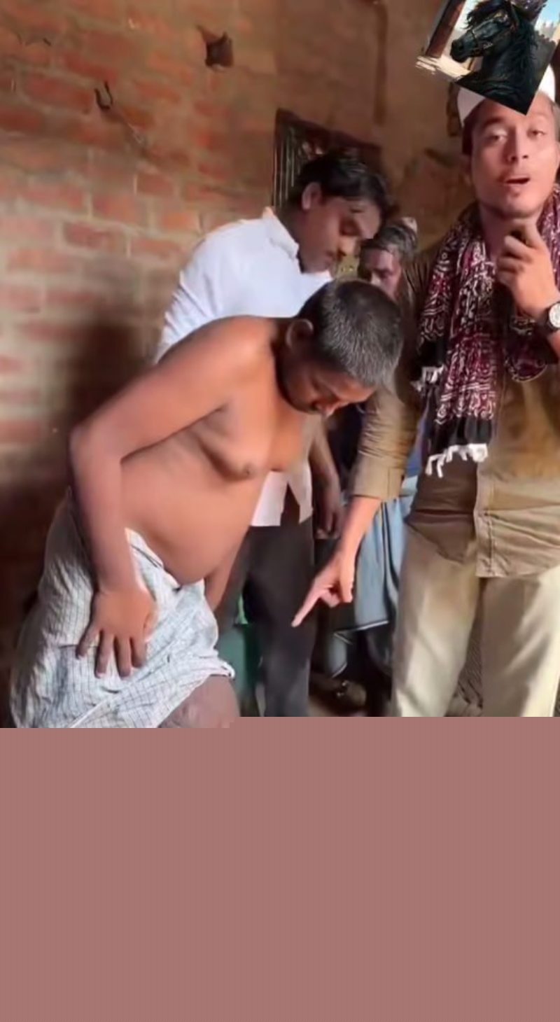 外国男子遭丝虫病入侵下体4 外国男子遭丝虫病入侵下体4