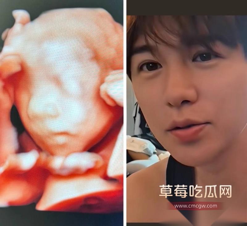 童锦程私生子曝光 21 童锦程私生子曝光 21