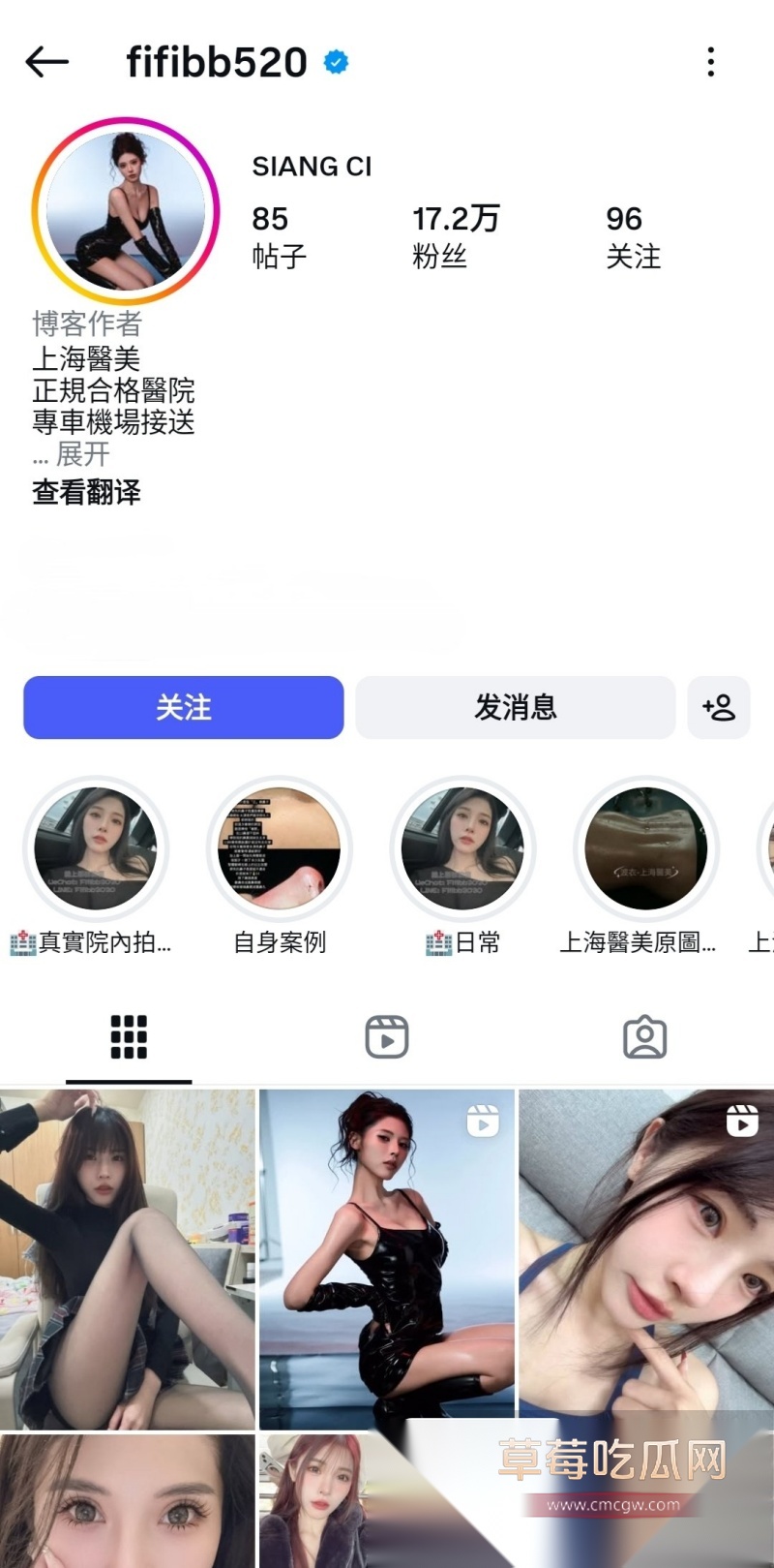 上海超漂亮医美院长 林香慈 5 上海超漂亮医美院长 林香慈 5