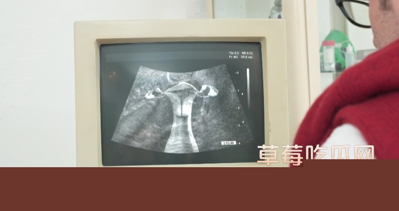 欧美猎奇做B超3 欧美猎奇做B超3