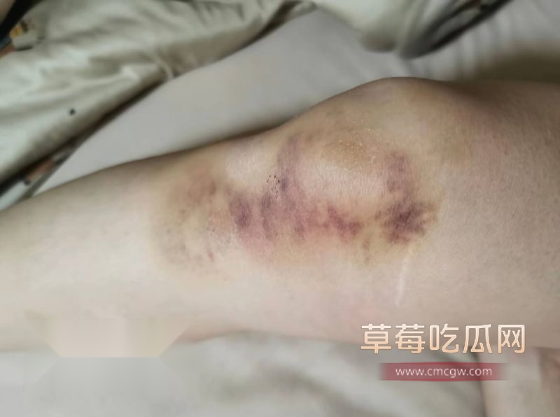 抖音女网红娜姐重生被丈夫高飞家暴3 抖音女网红娜姐重生被丈夫高飞家暴3