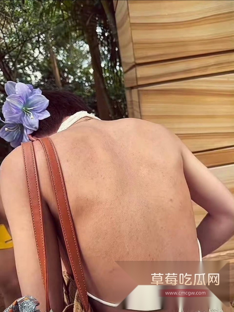 小澈梅毒 31 小澈梅毒 31