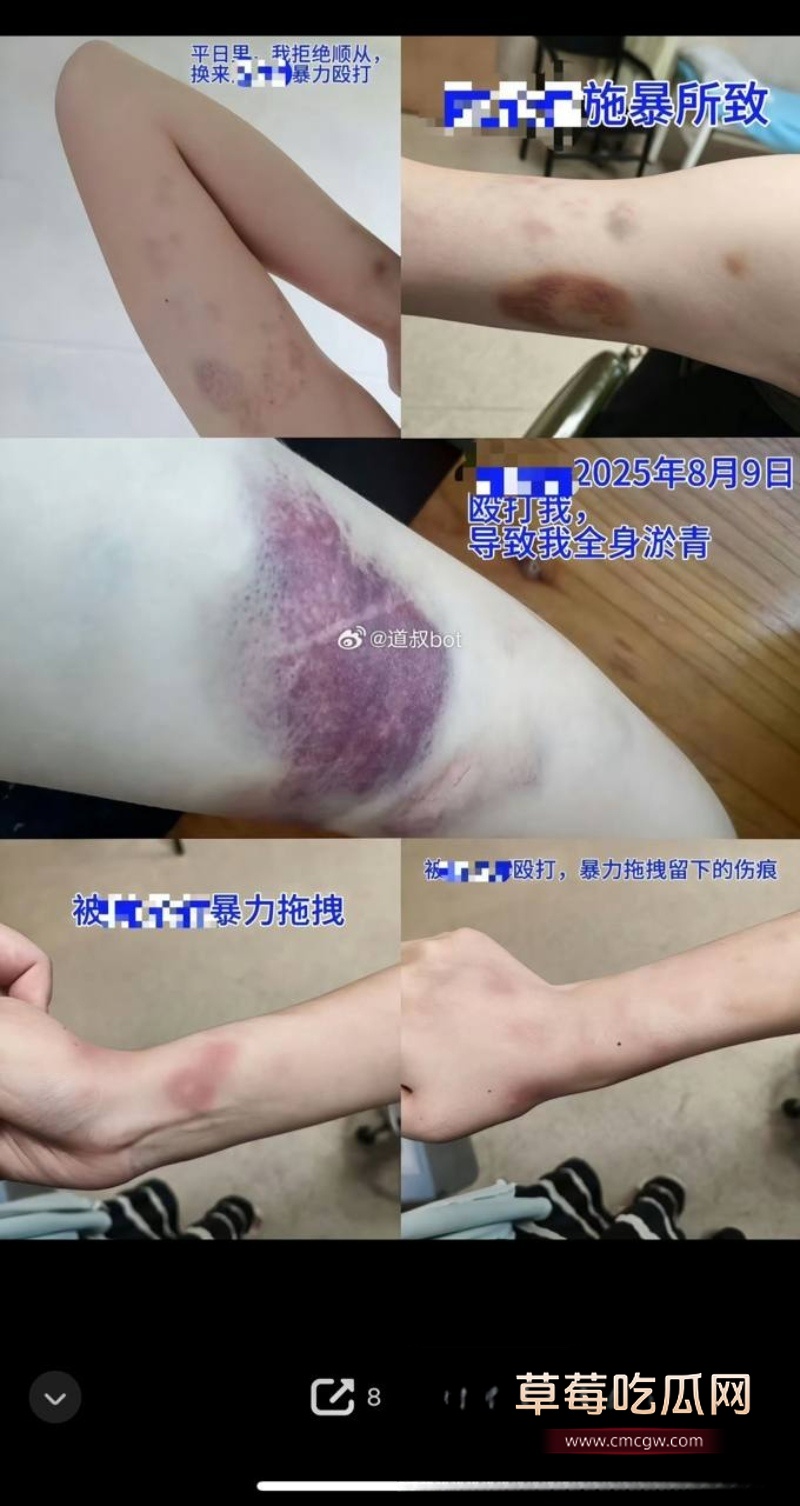 莆田涵江塘头学校老色鬼领导强上刚开腹女生 4