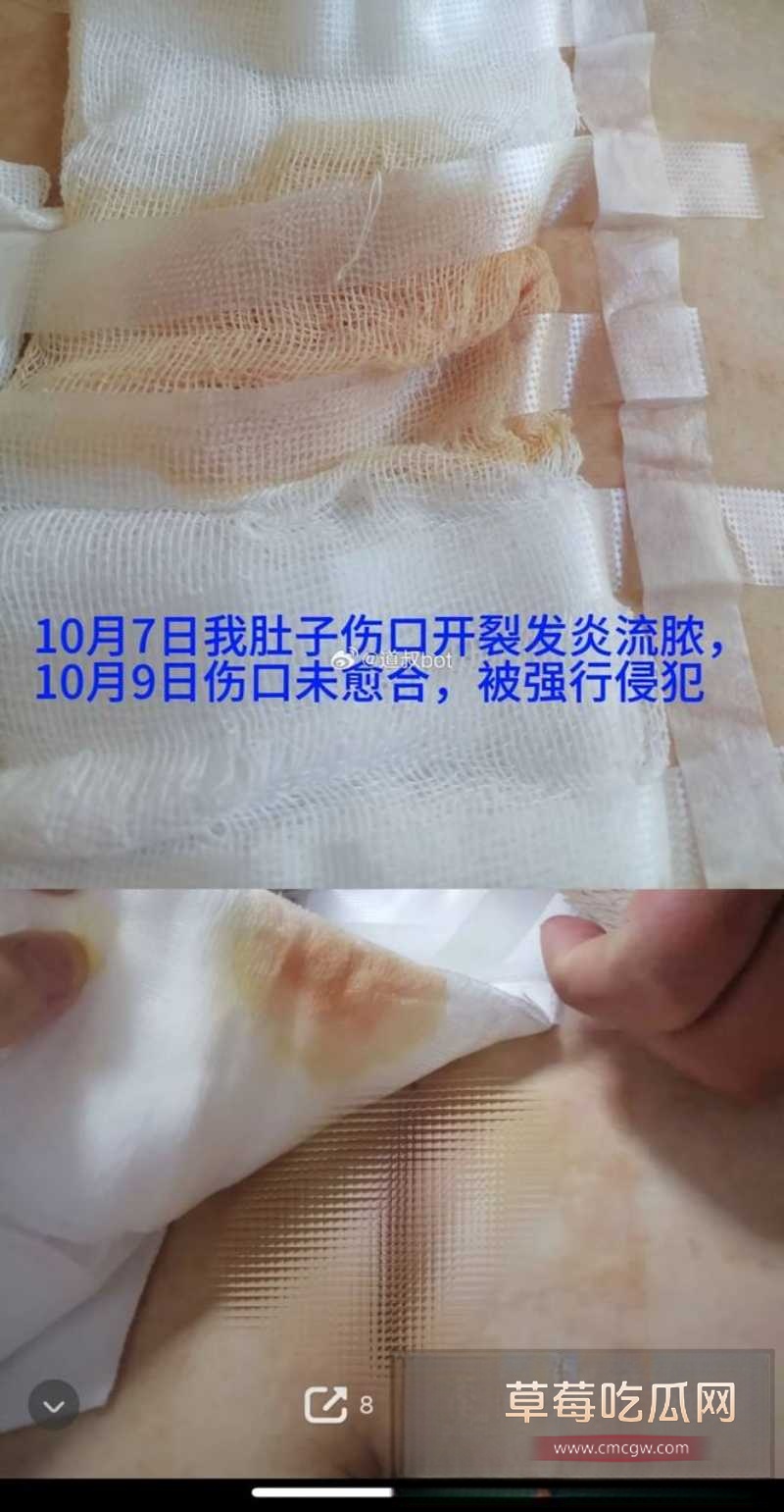 莆田涵江塘头学校老色鬼领导强上刚开腹女生 5