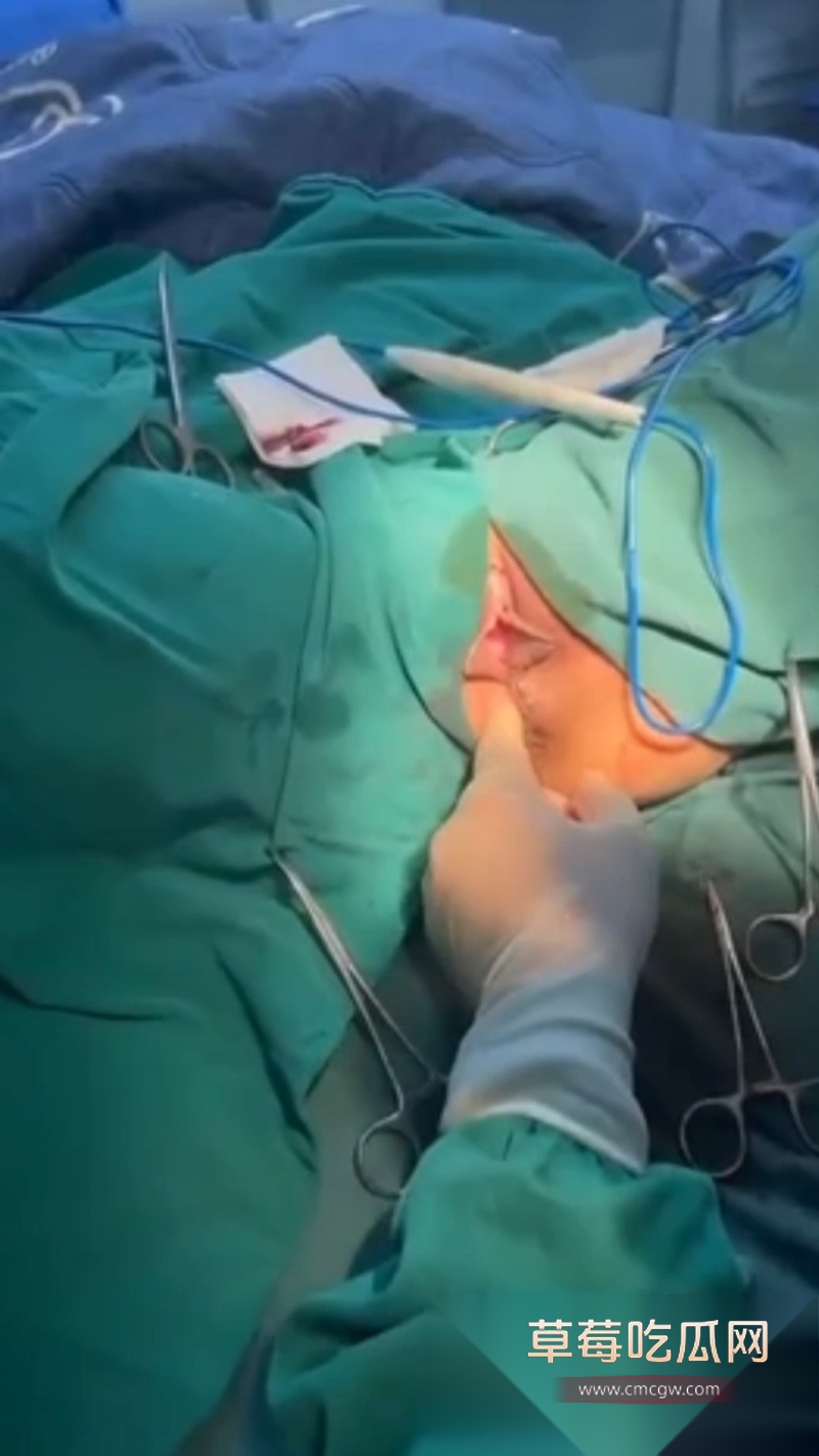 陕西中医学大学附属医院暴露女患者隐私部位 1