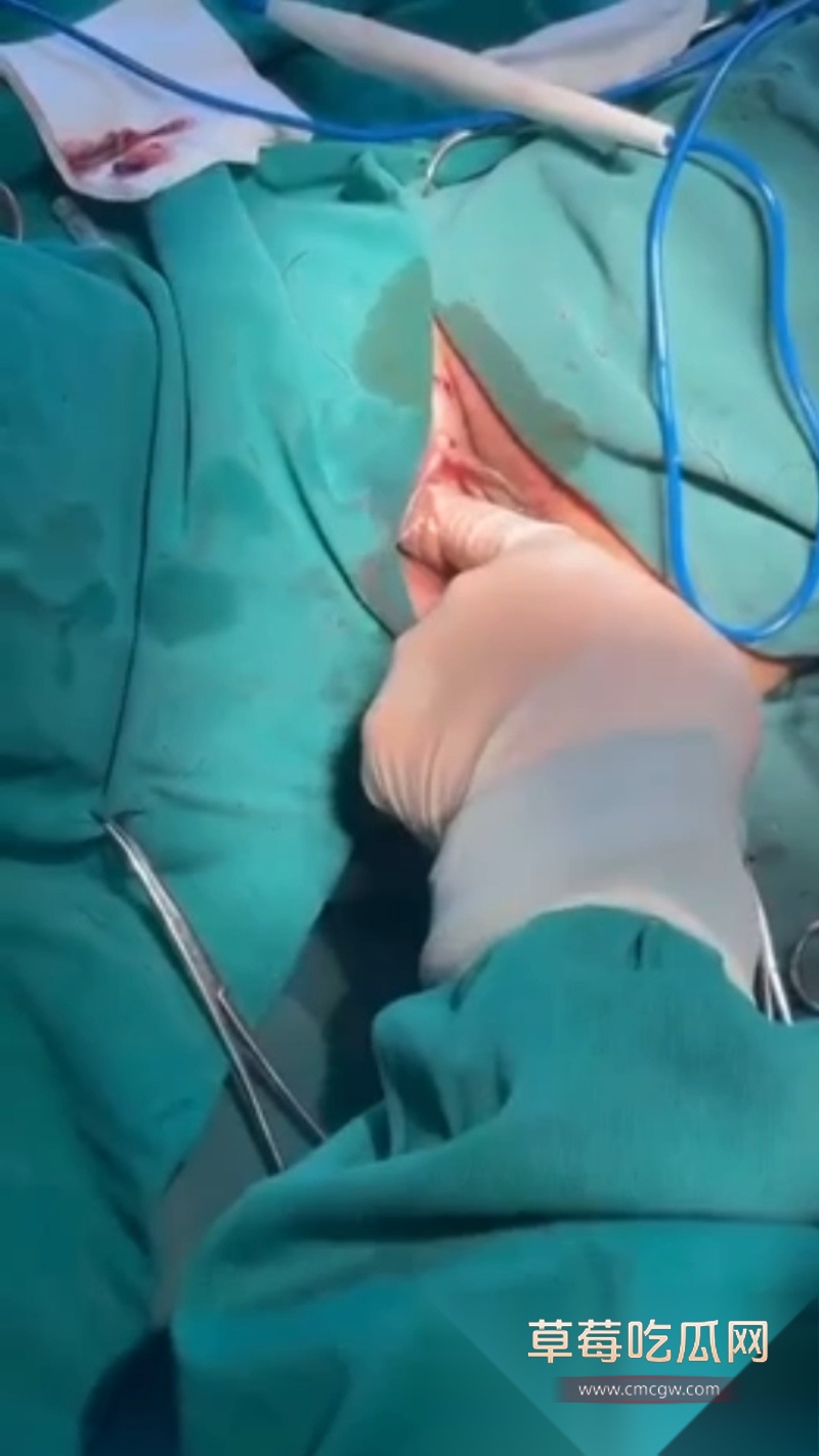 陕西中医学大学附属医院暴露女患者隐私部位 3
