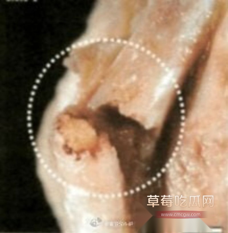 爱泼斯坦自缢后照片首度公开2