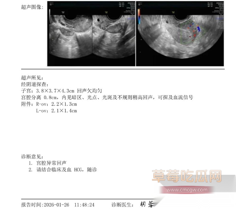 避雷湖南地质中学10号谭杰文 30