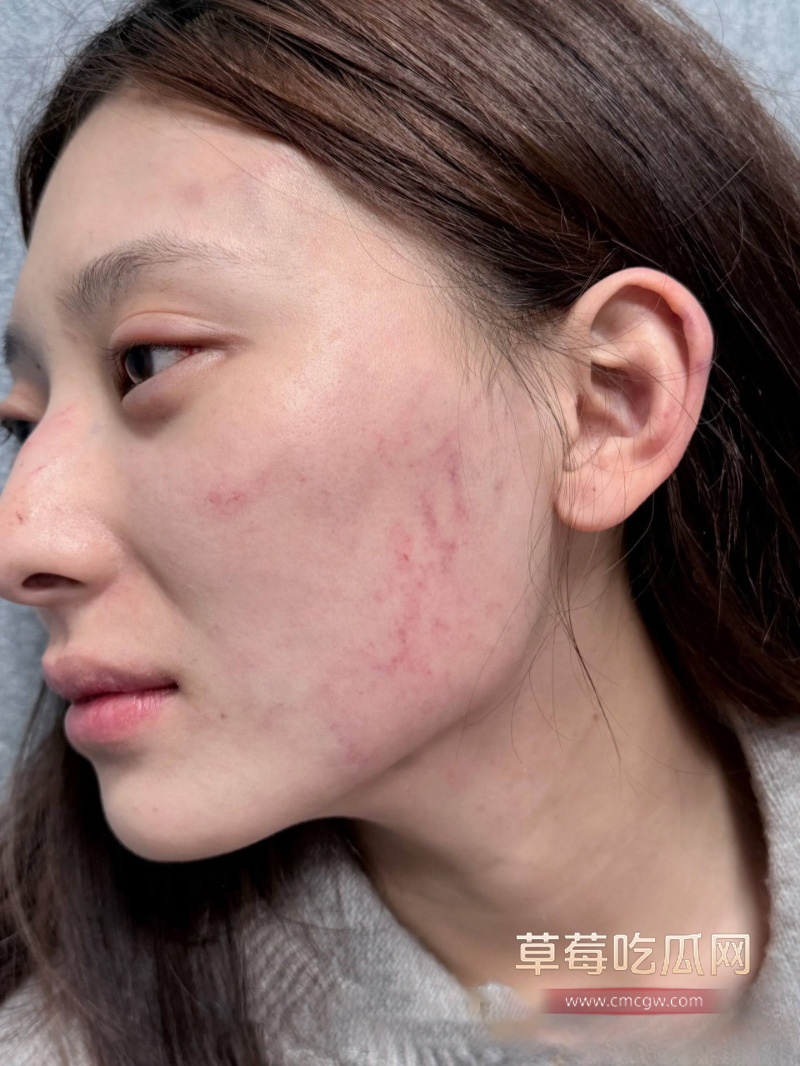 千万大V 张百乔 35 千万大V 张百乔 35
