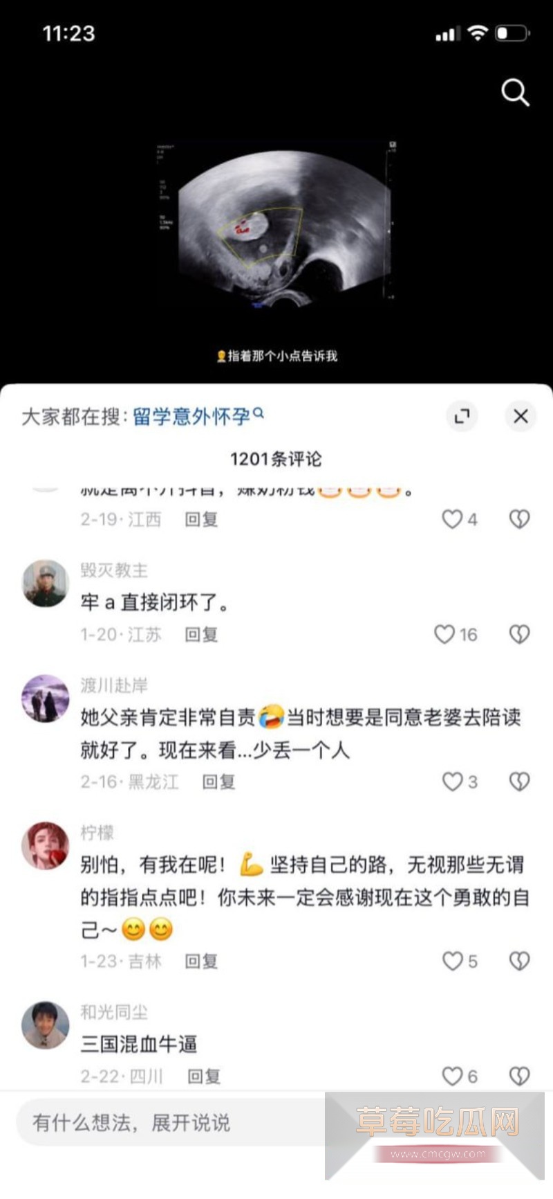 攀小宝8