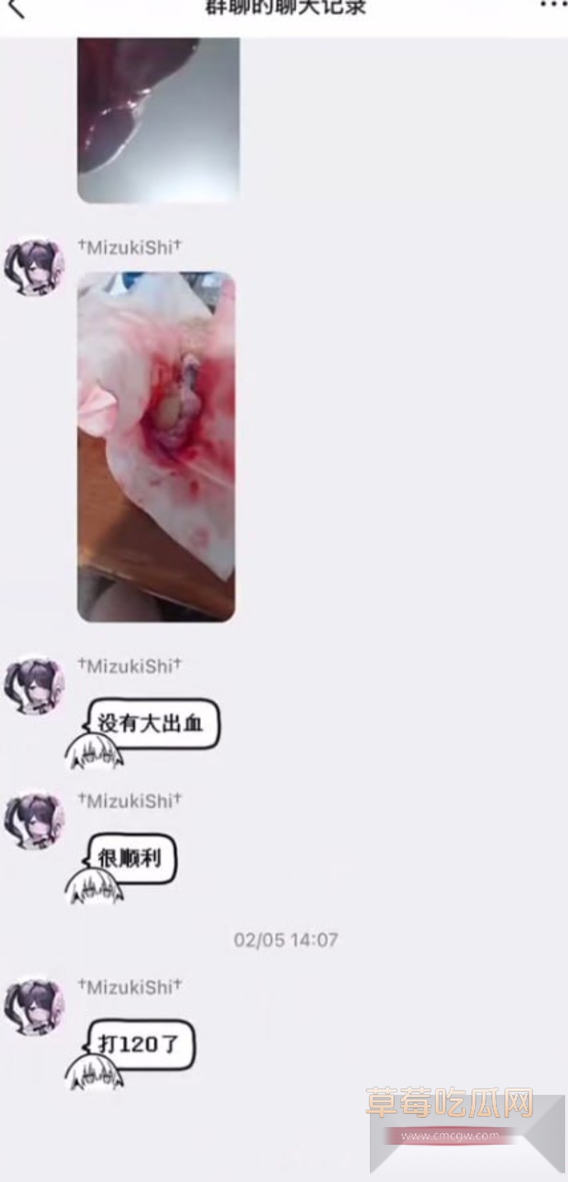 割蛋15